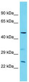 Sterile Alpha Motif Domain Containing 7 antibody, TA334865, Origene, Western Blot image 