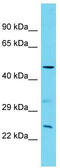 Sterile alpha motif domain-containing protein 7 antibody, TA334865, Origene, Western Blot image 