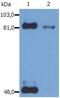 Signal Transducer And Activator Of Transcription 1 antibody, GTX23991, GeneTex, Western Blot image 