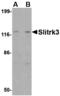 SLIT And NTRK Like Family Member 3 antibody, A14176, Boster Biological Technology, Western Blot image 