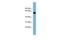 Glycoprotein Nmb antibody, GTX46705, GeneTex, Western Blot image 