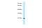 Guanylate kinase antibody, A10275, Boster Biological Technology, Western Blot image 