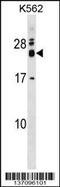 RNA Exonuclease 2 antibody, 59-066, ProSci, Western Blot image 