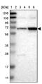Solute Carrier Family 4 Member 11 antibody, PA5-53730, Invitrogen Antibodies, Western Blot image 