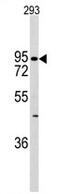 Cadherin 6 antibody, AP11373PU-N, Origene, Western Blot image 