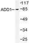 SRBP1 antibody, AP06003PU-N, Origene, Western Blot image 