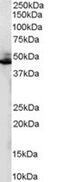 Adrenoceptor Beta 2 antibody, MBS420274, MyBioSource, Western Blot image 