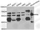 Fyn Related Src Family Tyrosine Kinase antibody, A7556, ABclonal Technology, Western Blot image 