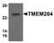 Transmembrane Protein 204 antibody, A13438, Boster Biological Technology, Western Blot image 