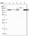 Apolipoprotein B antibody, NBP2-38608, Novus Biologicals, Western Blot image 