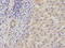 ADAM Metallopeptidase Domain 9 antibody, LS-C334028, Lifespan Biosciences, Immunohistochemistry paraffin image 