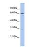 DEAQ-Box RNA Dependent ATPase 1 antibody, NBP1-57115, Novus Biologicals, Western Blot image 