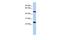 Transmembrane Protein 161B antibody, GTX45604, GeneTex, Western Blot image 