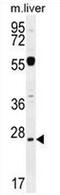 Nipsnap Homolog 3A antibody, AP52921PU-N, Origene, Western Blot image 