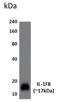 Interleukin 36 Beta antibody, GTX52841, GeneTex, Western Blot image 