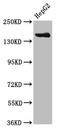 Carbamoyl-Phosphate Synthase 1 antibody, LS-C669845, Lifespan Biosciences, Western Blot image 