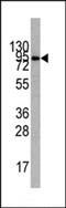 Phosphoinositide-3-Kinase Regulatory Subunit 1 antibody, MBS9209435, MyBioSource, Western Blot image 