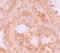 WD Repeat Domain 92 antibody, A13880, Boster Biological Technology, Immunohistochemistry paraffin image 