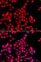 Tau Tubulin Kinase 2 antibody, LS-C349266, Lifespan Biosciences, Immunofluorescence image 