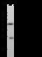 C-Type Lectin Domain Containing 9A antibody, 104746-T32, Sino Biological, Western Blot image 