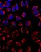 Inner Membrane Mitochondrial Protein antibody, GTX33318, GeneTex, Immunofluorescence image 