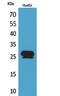 Calcyclin Binding Protein antibody, STJ96754, St John