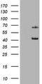 Keratin 5 antibody, LS-C336302, Lifespan Biosciences, Western Blot image 