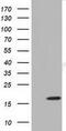 Transmembrane Protein 80 antibody, GTX83504, GeneTex, Western Blot image 