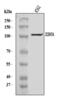 Zinc Finger CCCH-Type Containing 7A antibody, A15075-1, Boster Biological Technology, Western Blot image 