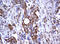 TNF Receptor Superfamily Member 8 antibody, LS-C175657, Lifespan Biosciences, Immunohistochemistry frozen image 