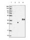 Complement Factor H Related 1 antibody, NBP2-54683, Novus Biologicals, Western Blot image 
