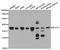 Ribosomal Protein Lateral Stalk Subunit P0 antibody, STJ27503, St John