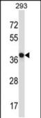 N-Terminal EF-Hand Calcium Binding Protein 1 antibody, PA5-48668, Invitrogen Antibodies, Western Blot image 