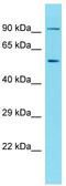 Archaelysin Family Metallopeptidase 1 antibody, TA331670, Origene, Western Blot image 