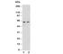 NADPH Oxidase 1 antibody, R30829, NSJ Bioreagents, Western Blot image 