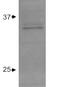 Apolipoprotein E antibody, GTX27620, GeneTex, Western Blot image 