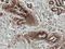 Matrix Metallopeptidase 7 antibody, LS-C777042, Lifespan Biosciences, Immunohistochemistry paraffin image 