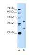 ST8 Alpha-N-Acetyl-Neuraminide Alpha-2,8-Sialyltransferase 2 antibody, orb325290, Biorbyt, Western Blot image 