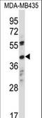 Olfactory Receptor Family 8 Subfamily K Member 1 antibody, LS-C163257, Lifespan Biosciences, Western Blot image 