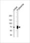 LIM Domain Kinase 2 antibody, LS-C203840, Lifespan Biosciences, Western Blot image 