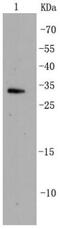 Cyclin Dependent Kinase 5 antibody, NBP2-67319, Novus Biologicals, Western Blot image 