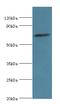 Sperm Associated Antigen 16 antibody, MBS1493086, MyBioSource, Western Blot image 