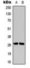 Snail Family Transcriptional Repressor 1 antibody, orb315708, Biorbyt, Western Blot image 