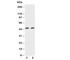 CD2 Molecule antibody, R30833, NSJ Bioreagents, Western Blot image 
