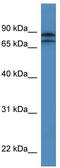 Kelch Like Family Member 22 antibody, TA343016, Origene, Western Blot image 