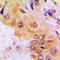 Cytochrome P450 Family 2 Subfamily A Member 7 antibody, LS-C352080, Lifespan Biosciences, Immunohistochemistry paraffin image 