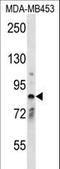 Cyclin And CBS Domain Divalent Metal Cation Transport Mediator 2 antibody, LS-C168883, Lifespan Biosciences, Western Blot image 