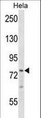 ZFP36 Ring Finger Protein Like 1 antibody, LS-C156859, Lifespan Biosciences, Western Blot image 