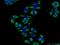 Leupaxin antibody, 11307-1-AP, Proteintech Group, Immunofluorescence image 
