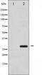 Acetyl-CoA Carboxylase Alpha antibody, orb99384, Biorbyt, Western Blot image 
